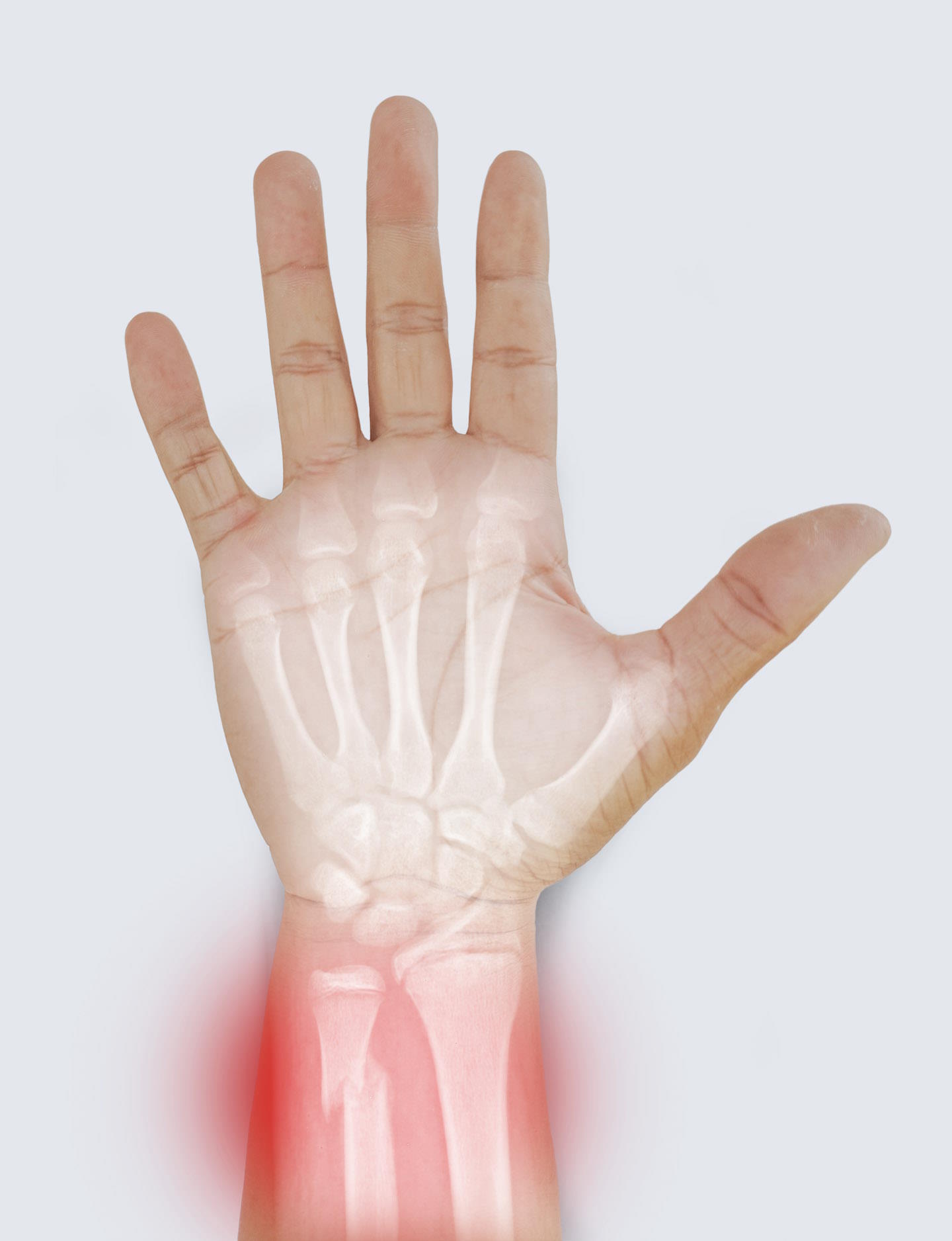 Preguntas Frecuentes sobre Fisioterapia para la Rehabilitación de las Fracturas de Hueso Preguntas Frecuentes sobre Fisioterapia para la Rehabilitación de las Fracturas de Hueso